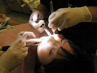 藤沢市の歯医者で歯周病治療
