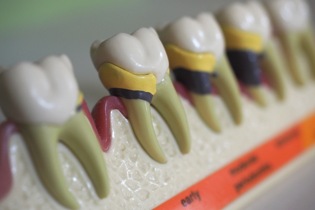 藤沢の歯医者のマイクロスコープ精密治療